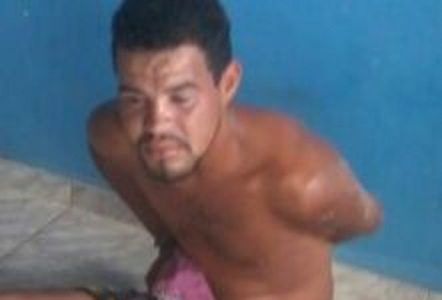 Homem é socorrido após ser atingido por golpes de faca na zona rural de Malhada