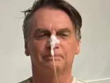 Jair Bolsonaro recebe alta do hospital após três semanas internado