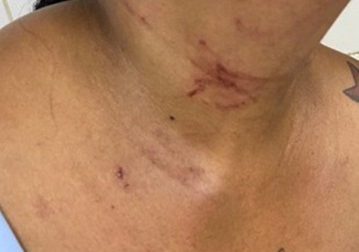 Mulher fica ferida após discussão com companheiro em Guanambi