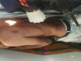 Homem é atacado com golpes de facão durante briga entre irmãos em Palmas de Monte Alto Homem é atacado com golpes de facão durante briga entre irmãos em Palmas de Monte Alto