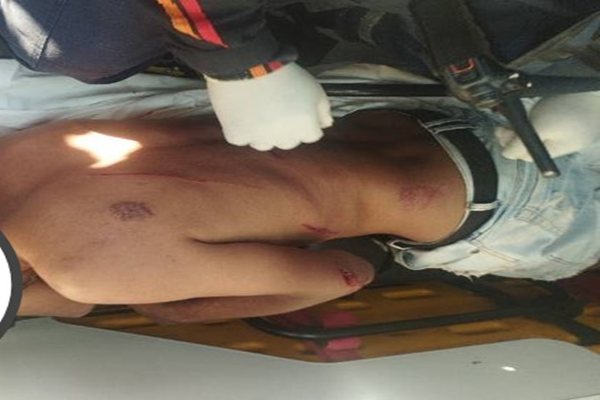 Homem é atacado com golpes de facão durante briga entre irmãos em Palmas de Monte Alto