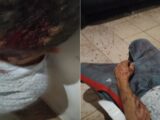 Homem é internado em estado grave após ser agredido com pedaço de madeira na zona rural de Brumado Homem é internado em estado grave após ser agredido com pedaço de madeira na zona rural de Brumado