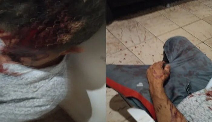 Homem é internado em estado grave após ser agredido com pedaço de madeira na zona rural de Brumado