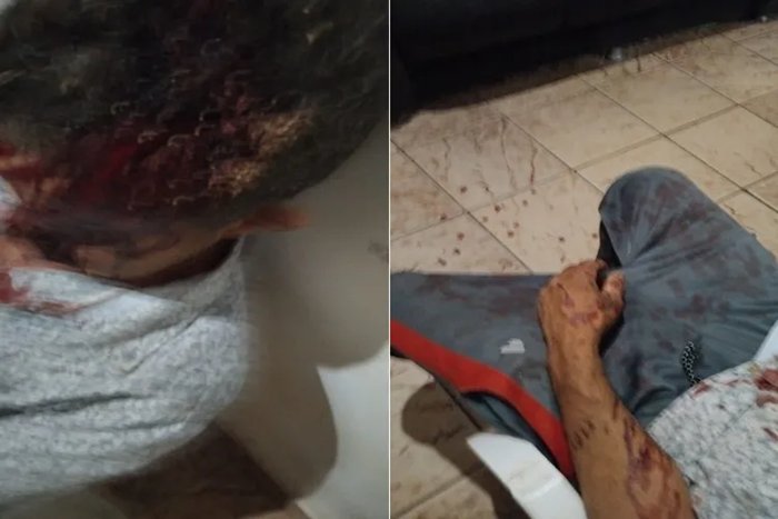 Homem é internado em estado grave após ser agredido com pedaço de madeira na zona rural de Brumado