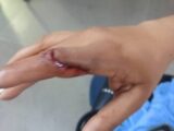 Mulher fica ferida após agressão e homem é conduzido à delegacia em Pindaí
