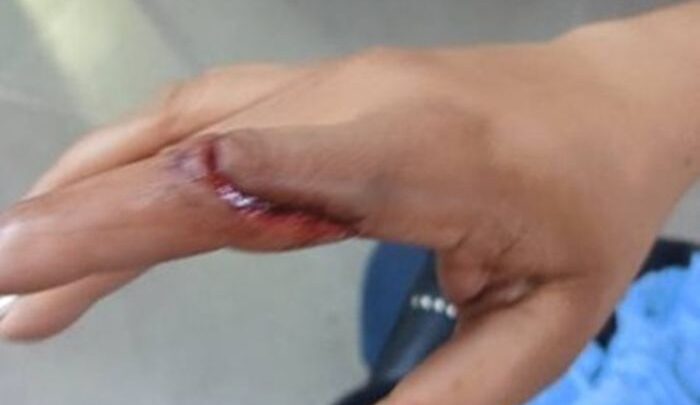Mulher fica ferida após agressão e homem é conduzido à delegacia em Pindaí